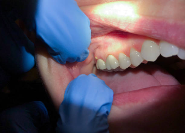 Best Cosmetic Emergency Dentistry in Clayton, OH